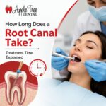 How Long Does a Root Canal Take
