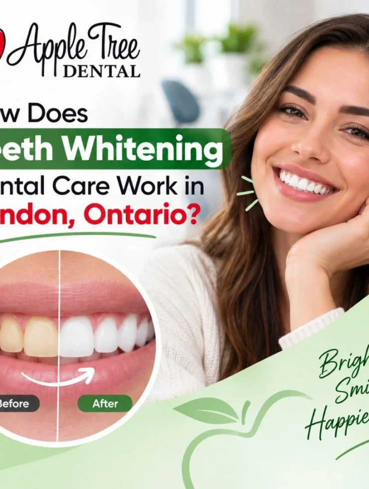 teeth whitening dental care​
