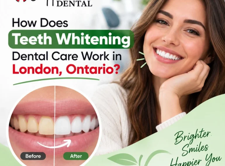 teeth whitening dental care​