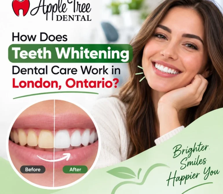 teeth whitening dental care​