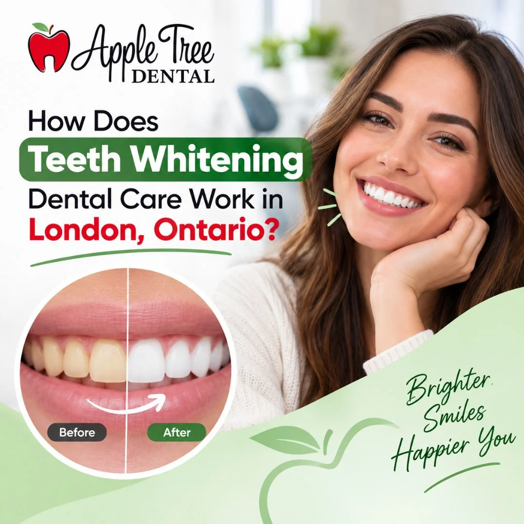 teeth whitening dental care​