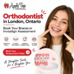 London Orthodontist