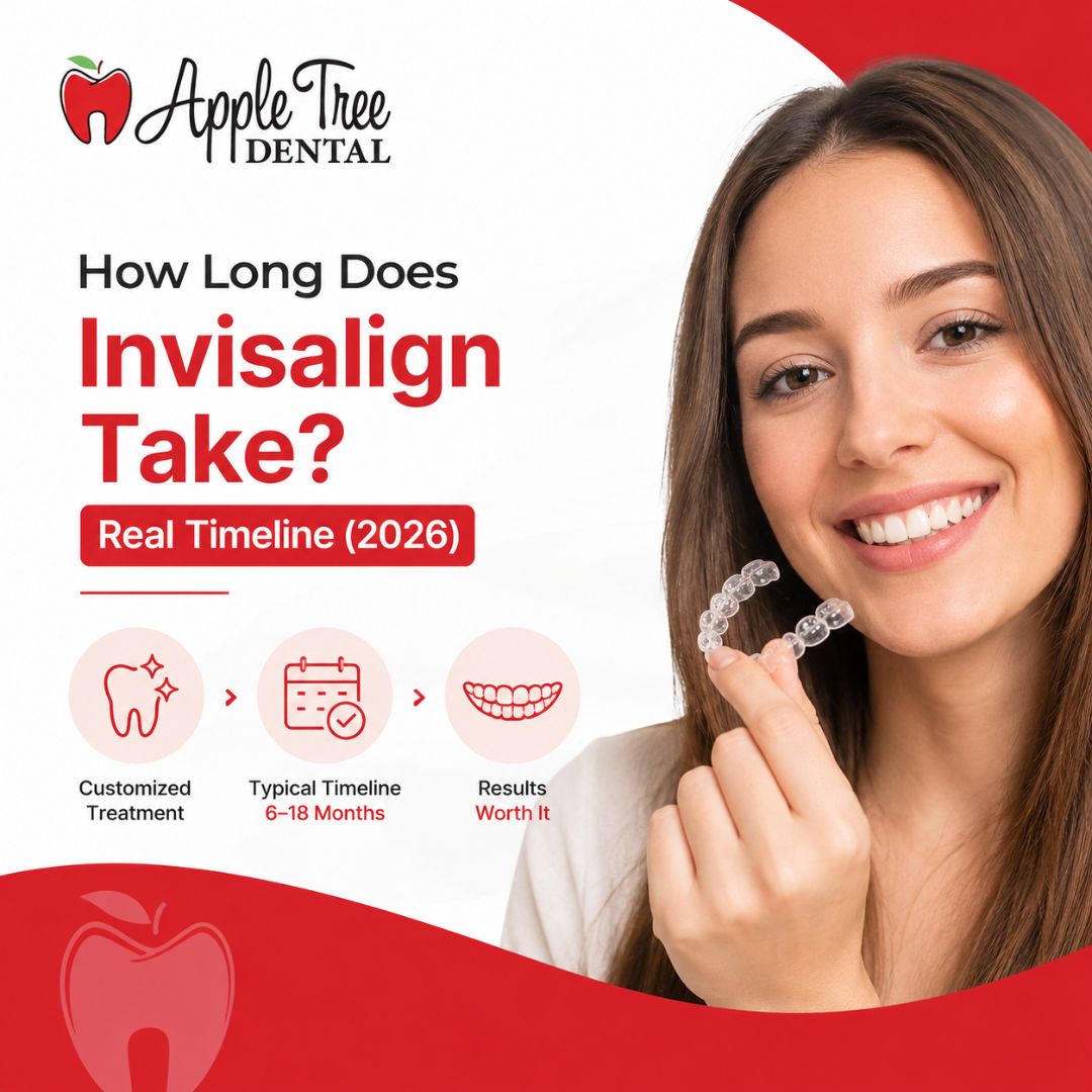 how long does invisalign take